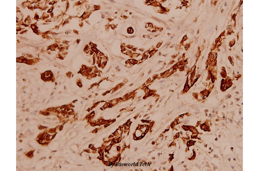 Anti-Cytokeratin 16 (S451) Antibody from Bioworld Technology (BS1202) - Antibodies.com