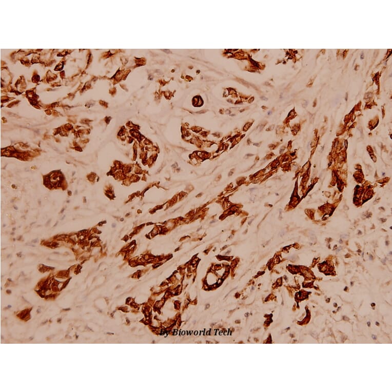 Anti-Cytokeratin 16 (S451) Antibody from Bioworld Technology (BS1202) - Antibodies.com