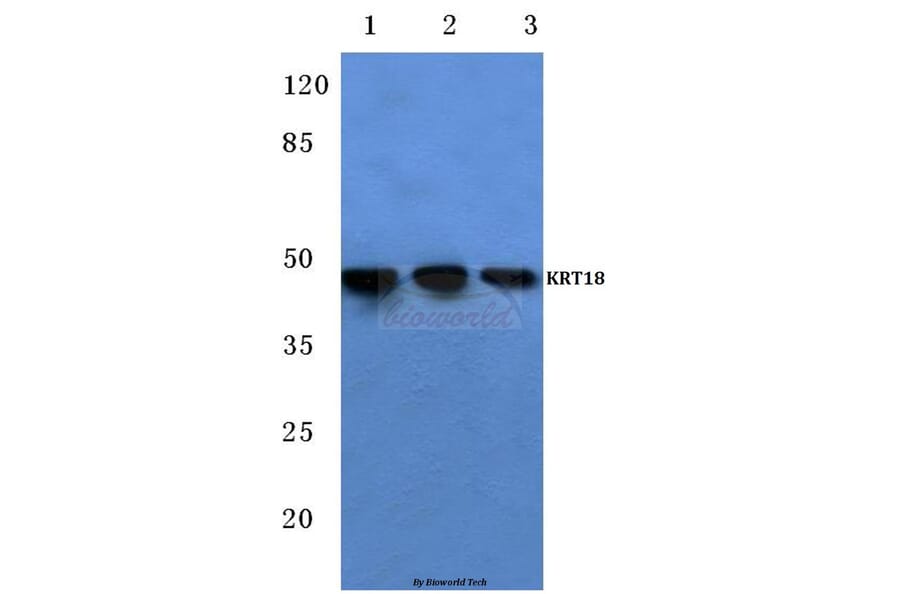 Anti-Cytokeratin 18 (T410) Antibody from Bioworld Technology (BS1204) - Antibodies.com