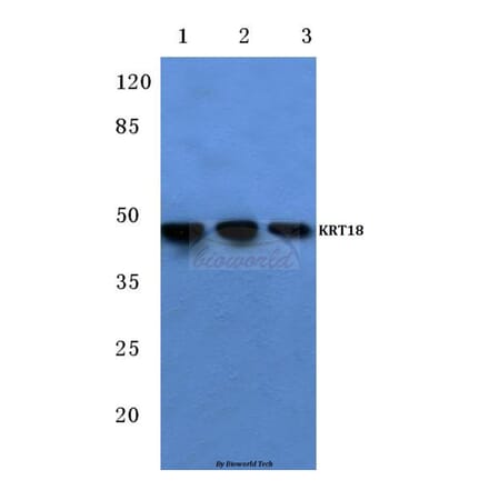 Anti-Cytokeratin 18 (T410) Antibody from Bioworld Technology (BS1204) - Antibodies.com