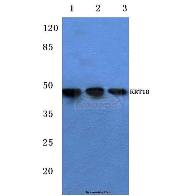 Anti-Cytokeratin 18 (T410) Antibody from Bioworld Technology (BS1204) - Antibodies.com