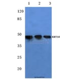 Anti-Cytokeratin 18 (T410) Antibody from Bioworld Technology (BS1204) - Antibodies.com