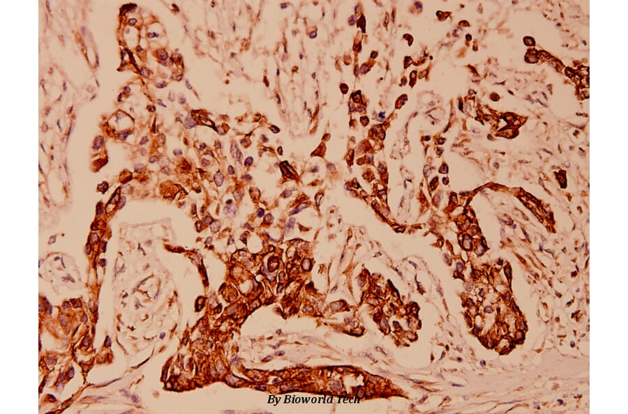 Anti-Cytokeratin 18 (T410) Antibody from Bioworld Technology (BS1204) - Antibodies.com