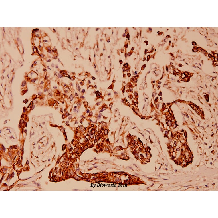 Anti-Cytokeratin 18 (T410) Antibody from Bioworld Technology (BS1204) - Antibodies.com