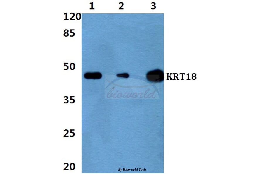 Anti-Cytokeratin 18 (P27) Antibody from Bioworld Technology (BS1205) - Antibodies.com