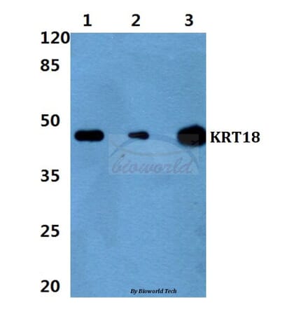 Anti-Cytokeratin 18 (P27) Antibody from Bioworld Technology (BS1205) - Antibodies.com