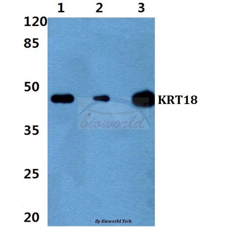 Anti-Cytokeratin 18 (P27) Antibody from Bioworld Technology (BS1205) - Antibodies.com