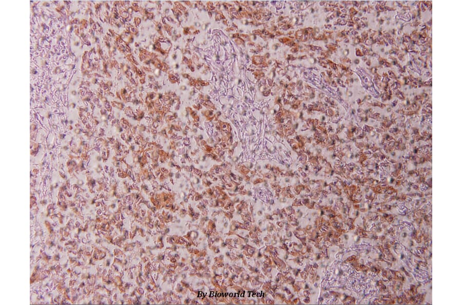 Anti-Cytokeratin 18 (P27) Antibody from Bioworld Technology (BS1205) - Antibodies.com