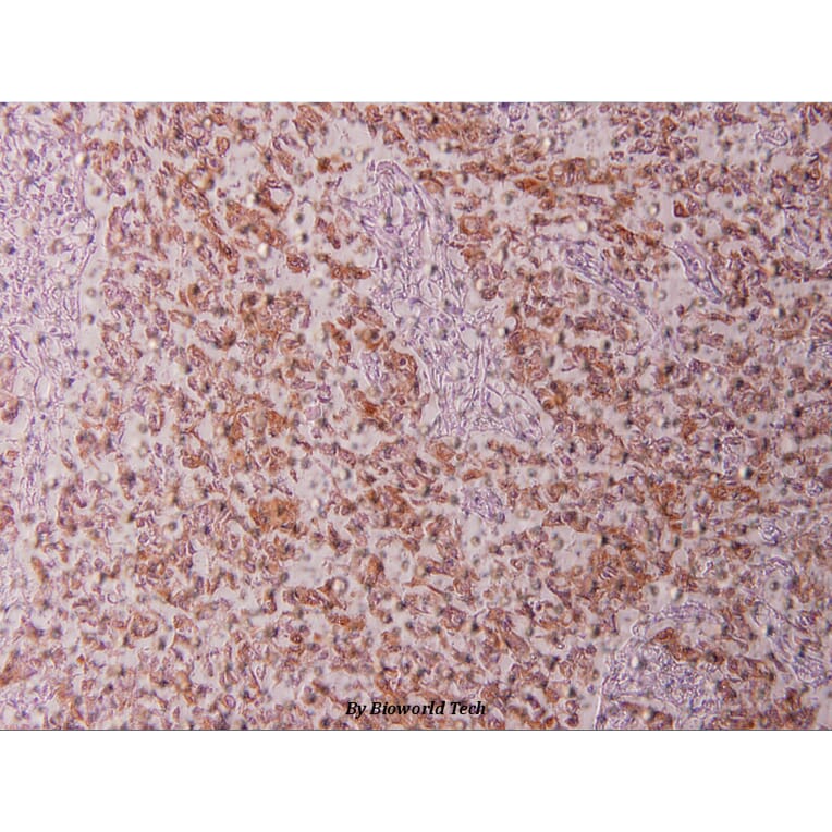 Anti-Cytokeratin 18 (P27) Antibody from Bioworld Technology (BS1205) - Antibodies.com