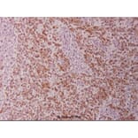 Anti-Cytokeratin 18 (P27) Antibody from Bioworld Technology (BS1205) - Antibodies.com
