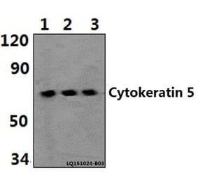 Anti-Cytokeratin 5 (S573) Antibody from Bioworld Technology (BS1208) - Antibodies.com