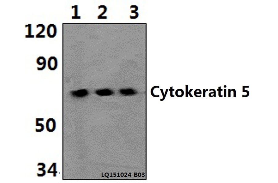 Anti-Cytokeratin 5 (S573) Antibody from Bioworld Technology (BS1208) - Antibodies.com
