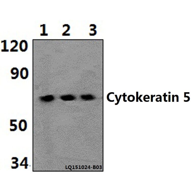 Anti-Cytokeratin 5 (S573) Antibody from Bioworld Technology (BS1208) - Antibodies.com