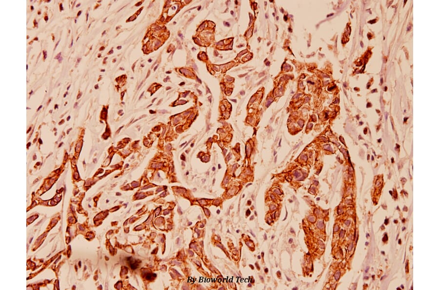 Anti-Cytokeratin 5 (S573) Antibody from Bioworld Technology (BS1208) - Antibodies.com