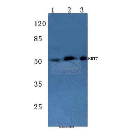 Anti-Cytokeratin 7 (L451) Antibody from Bioworld Technology (BS1209) - Antibodies.com