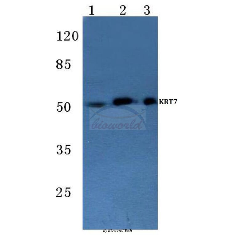 Anti-Cytokeratin 7 (L451) Antibody from Bioworld Technology (BS1209) - Antibodies.com