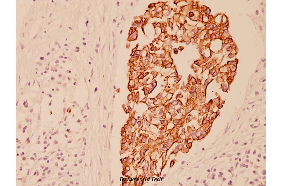 Anti-Cytokeratin 7 (L451) Antibody from Bioworld Technology (BS1209) - Antibodies.com