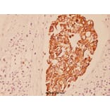 Anti-Cytokeratin 7 (L451) Antibody from Bioworld Technology (BS1209) - Antibodies.com