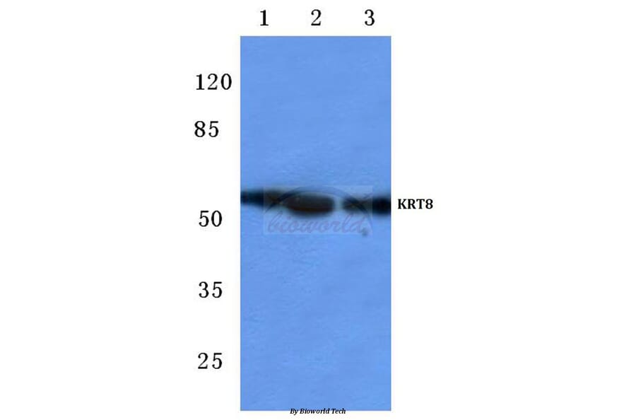Anti-Cytokeratin 8 (V463) Antibody from Bioworld Technology (BS1210) - Antibodies.com