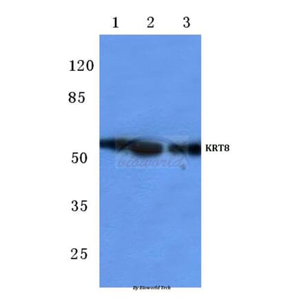 Anti-Cytokeratin 8 (V463) Antibody from Bioworld Technology (BS1210) - Antibodies.com