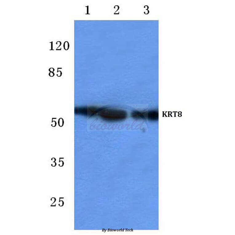 Anti-Cytokeratin 8 (V463) Antibody from Bioworld Technology (BS1210) - Antibodies.com