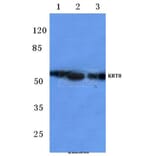 Anti-Cytokeratin 8 (V463) Antibody from Bioworld Technology (BS1210) - Antibodies.com