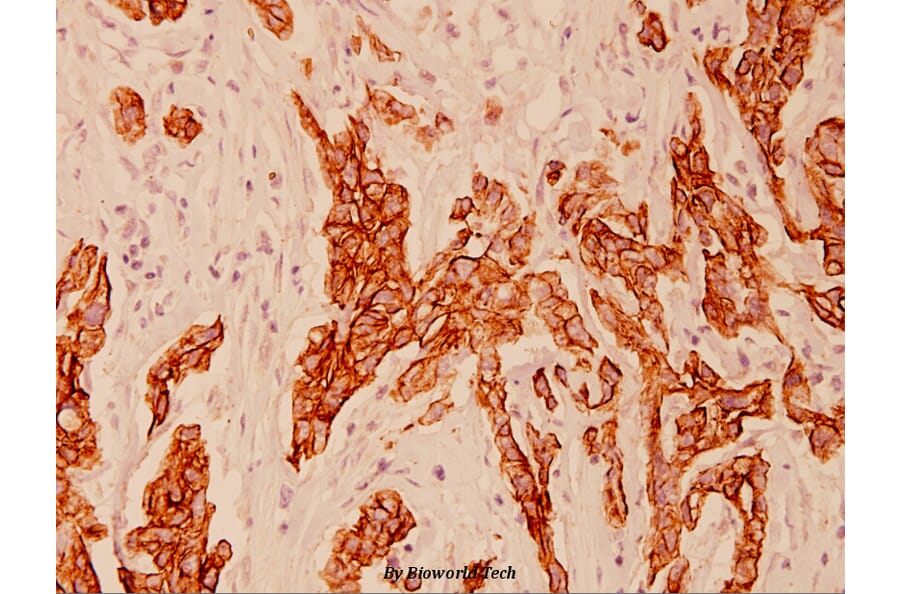 Anti-Cytokeratin 8 (V463) Antibody from Bioworld Technology (BS1210) - Antibodies.com