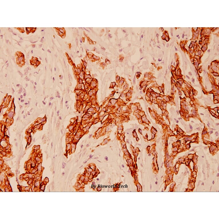 Anti-Cytokeratin 8 (V463) Antibody from Bioworld Technology (BS1210) - Antibodies.com