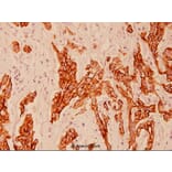 Anti-Cytokeratin 8 (V463) Antibody from Bioworld Technology (BS1210) - Antibodies.com