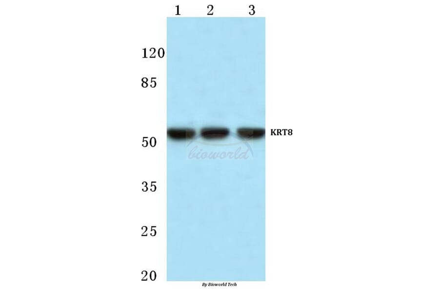 Anti-Cytokeratin 8 (V67) Antibody from Bioworld Technology (BS1211) - Antibodies.com