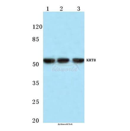 Anti-Cytokeratin 8 (V67) Antibody from Bioworld Technology (BS1211) - Antibodies.com