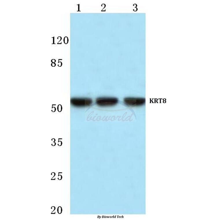 Anti-Cytokeratin 8 (V67) Antibody from Bioworld Technology (BS1211) - Antibodies.com