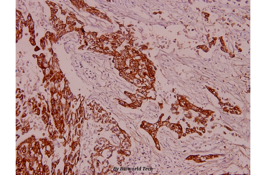 Anti-Cytokeratin 8 (V67) Antibody from Bioworld Technology (BS1211) - Antibodies.com