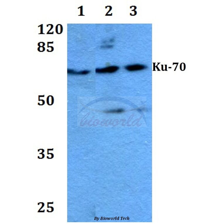 AntiKu70 (R586) Anticuerpo (A25240)