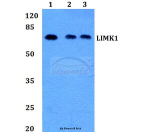 Anti-LIMK1 (D502) Antibody from Bioworld Technology (BS1214) - Antibodies.com