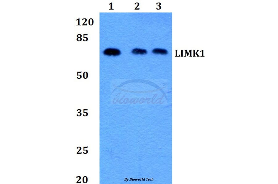 Anti-LIMK1 (D502) Antibody from Bioworld Technology (BS1214) - Antibodies.com