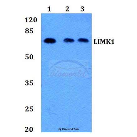 Anti-LIMK1 (D502) Antibody from Bioworld Technology (BS1214) - Antibodies.com