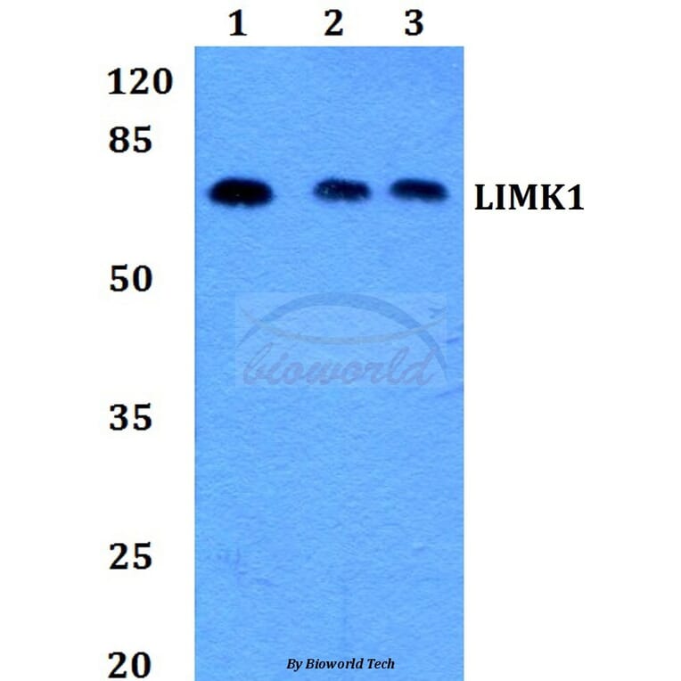 Anti-LIMK1 (D502) Antibody from Bioworld Technology (BS1214) - Antibodies.com