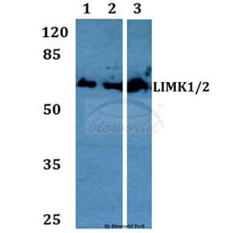 Anti-LIMK1/2 (D402) Antibody from Bioworld Technology (BS1215) - Antibodies.com