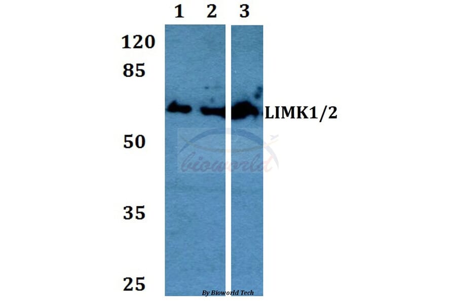 Anti-LIMK1/2 (D402) Antibody from Bioworld Technology (BS1215) - Antibodies.com