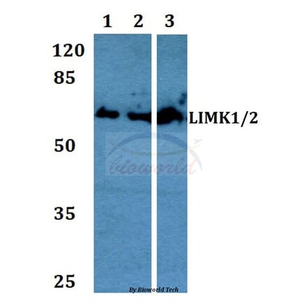 Anti-LIMK1/2 (D402) Antibody from Bioworld Technology (BS1215) - Antibodies.com
