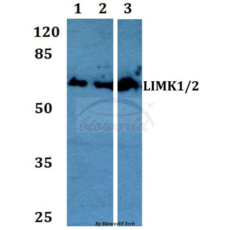 Anti-LIMK1/2 (D402) Antibody from Bioworld Technology (BS1215) - Antibodies.com