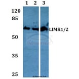 Anti-LIMK1/2 (D402) Antibody from Bioworld Technology (BS1215) - Antibodies.com