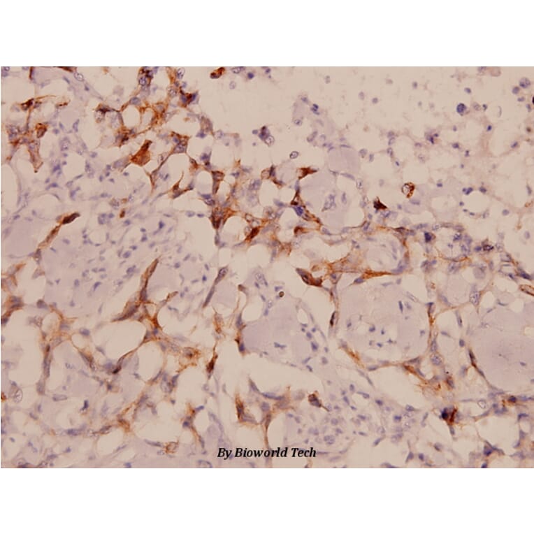 Anti-LIMK1/2 (D402) Antibody from Bioworld Technology (BS1215) - Antibodies.com