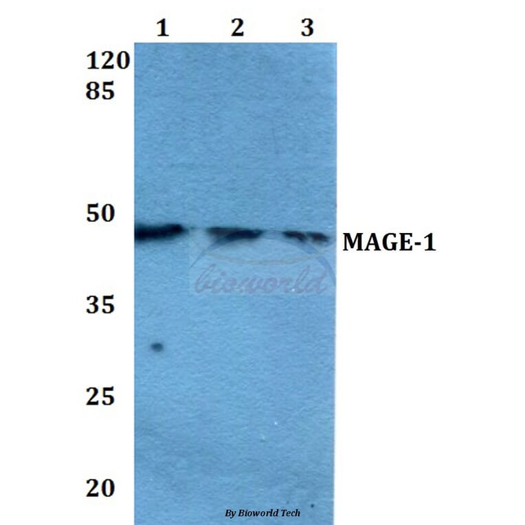 Anti-MAGE-1 (F293) Antibody from Bioworld Technology (BS1217) - Antibodies.com