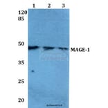 Anti-MAGE-1 (F293) Antibody from Bioworld Technology (BS1217) - Antibodies.com