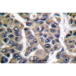 Anti-MAGE-1 (F293) Antibody from Bioworld Technology (BS1217) - Antibodies.com