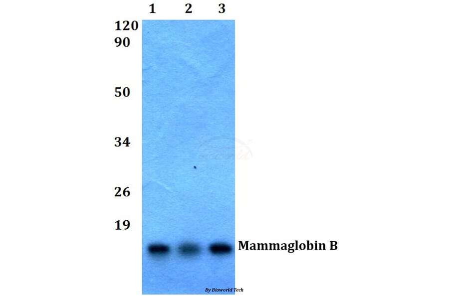 Anti-Mammaglobin B (K23) Antibody from Bioworld Technology (BS1218) - Antibodies.com