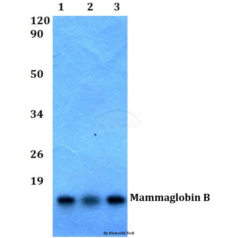Anti-Mammaglobin B (K23) Antibody from Bioworld Technology (BS1218) - Antibodies.com
