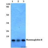 Anti-Mammaglobin B (K23) Antibody from Bioworld Technology (BS1218) - Antibodies.com